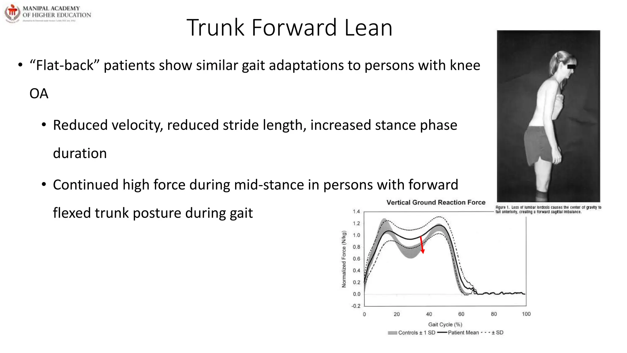 Trunk Forward Lean
• “Flat-back” patients show similar gait adaptations to persons with knee
OA
• Reduced velocity, reduced stride length, increased stance phase
duration
• Continued high force during mid-stance in persons with forward
flexed trunk posture during gait
 