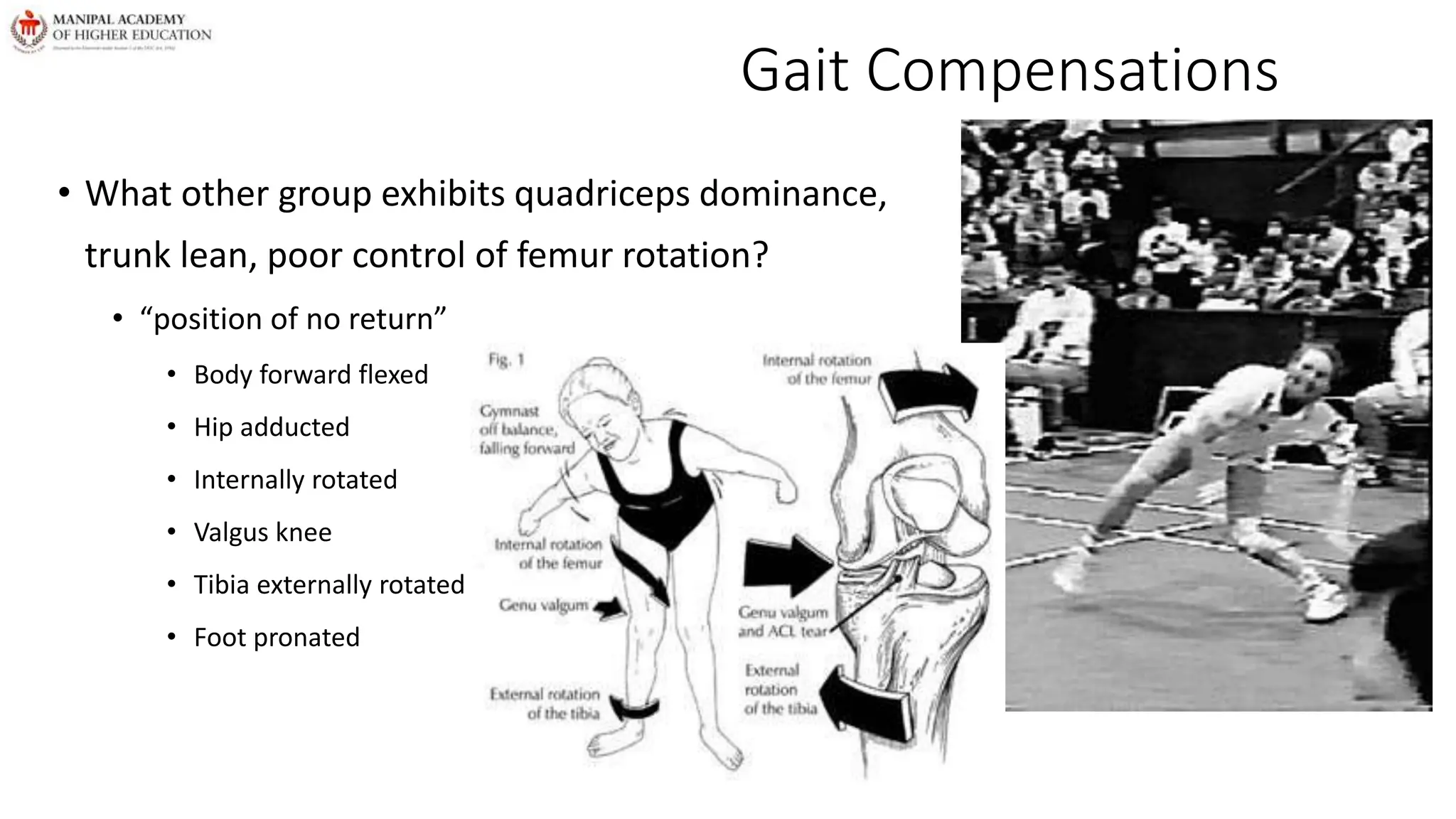 Gait Compensations
• What other group exhibits quadriceps dominance,
trunk lean, poor control of femur rotation?
• “position of no return”
• Body forward flexed
• Hip adducted
• Internally rotated
• Valgus knee
• Tibia externally rotated
• Foot pronated
 