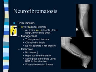 coreimportantpedssyndromes.ppt