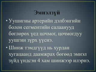• Уушигны артерийн дэлбэнгийн 
болон сегментийн салаанууд 
бөглөрөх үед цочмог, цочмогдуу 
уушгин зүрх үүснэ. 
• Шинж тэмдгүүд нь хурдан 
хугацаанд даамжрах бөгөөд эмнэл 
зүйд үндсэн 4 хам шинжээр илэрнэ. 
 
