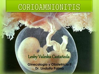 Lesby Valeska Castañeda
Ginecología y Obstetricia II
Dr. Lindolfo Palma
 