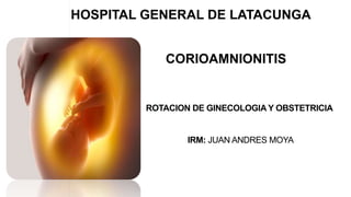 CORIOAMNIONITIS
IRM: JUAN ANDRES MOYA
ROTACION DE GINECOLOGIA Y OBSTETRICIA
HOSPITAL GENERAL DE LATACUNGA
 
