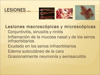 Lesiones macroscópicas y microscópicas
 Conjuntivitis, sinusitis y rinitis
 Inflamación de la mucosa nasal y de los senos
  infraorbitarios
 Exudado en los senos infraorbitarios
 Edema subcutáneo de la cara
 Ocasionalmente neumonía y aerosaculitis
 