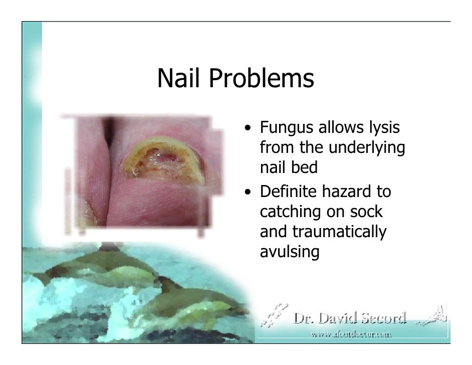 Corn And Nail Presentataion To Residents