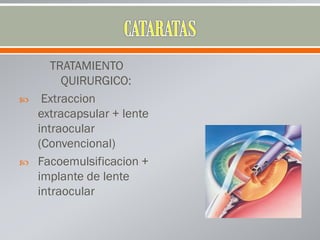 TRATAMIENTO
QUIRURGICO:
 Extraccion
extracapsular + lente
intraocular
(Convencional)
 Facoemulsificacion +
implante de lente
intraocular
 