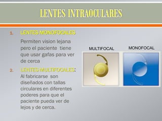 1. LENTES MONOFOCALES
Permiten vision lejana
pero el paciente tiene
que usar gafas para ver
de cerca
2. LENTES MULTIFOCALES:
Al fabricarse son
diseñados con tallas
circulares en diferentes
poderes para que el
paciente pueda ver de
lejos y de cerca.
MULTIFOCAL MONOFOCAL
 