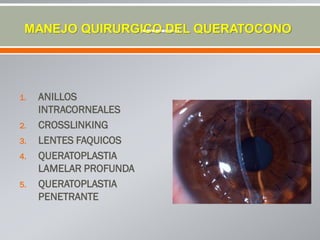 1. ANILLOS
INTRACORNEALES
2. CROSSLINKING
3. LENTES FAQUICOS
4. QUERATOPLASTIA
LAMELAR PROFUNDA
5. QUERATOPLASTIA
PENETRANTE
MANEJO QUIRURGICO DEL QUERATOCONO
 