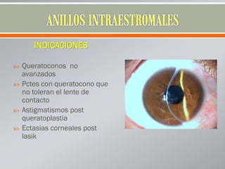 INDICACIONES
 Queratoconos no
avanzados
 Pctes con queratocono que
no toleran el lente de
contacto
 Astigmatismos post
queratoplastia
 Ectasias corneales post
lasik
 