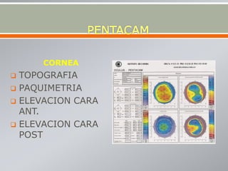 CORNEA
 TOPOGRAFIA
 PAQUIMETRIA
 ELEVACION CARA
ANT.
 ELEVACION CARA
POST
 