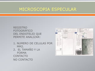 REGISTRO
FOTOGRÁFICO
DEL ENDOTELIO QUE
PERMITE ANALIZAR:
1. NUMERO DE CELULAS POR
MM2.
2. EL TAMAÑO Y LA
FORMA
CONTACTO
NO CONTACTO
 