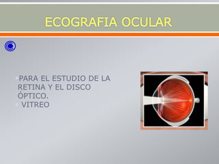 PARA EL ESTUDIO DE LA
RETINA Y EL DISCO
ÓPTICO.
 VITREO
 