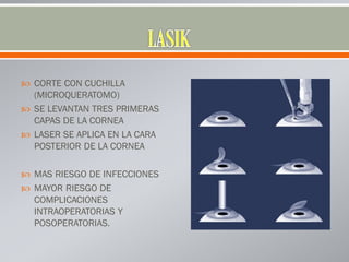  CORTE CON CUCHILLA
(MICROQUERATOMO)
 SE LEVANTAN TRES PRIMERAS
CAPAS DE LA CORNEA
 LASER SE APLICA EN LA CARA
POSTERIOR DE LA CORNEA
 MAS RIESGO DE INFECCIONES
 MAYOR RIESGO DE
COMPLICACIONES
INTRAOPERATORIAS Y
POSOPERATORIAS.
 