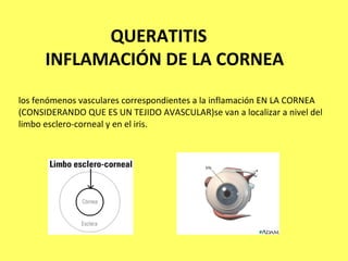 QUERATITIS
      INFLAMACIÓN DE LA CORNEA
los fenómenos vasculares correspondientes a la inflamación EN LA CORNEA
(CONSIDERANDO QUE ES UN TEJIDO AVASCULAR)se van a localizar a nivel del
limbo esclero-corneal y en el iris.
 