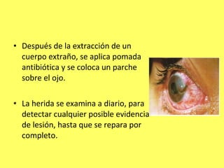 • Después de la extracción de un
  cuerpo extraño, se aplica pomada
  antibiótica y se coloca un parche
  sobre el ojo.

• La herida se examina a diario, para
  detectar cualquier posible evidencia
  de lesión, hasta que se repara por
  completo.
 