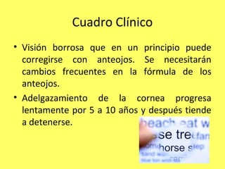 Cuadro Clínico
• Visión borrosa que en un principio puede
  corregirse con anteojos. Se necesitarán
  cambios frecuentes en la fórmula de los
  anteojos.
• Adelgazamiento de la cornea progresa
  lentamente por 5 a 10 años y después tiende
  a detenerse.
 