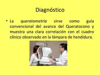 Diagnóstico
• La     queratometría     sirve   como    guía
  convencional del avance del Queratocono y
  muestra una clara correlación con el cuadro
  clínico observado en la lámpara de hendidura.
 