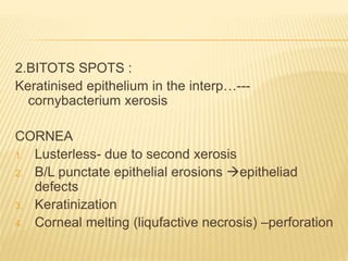 2.BITOTS SPOTS :
Keratinised epithelium in the interp…---
cornybacterium xerosis
CORNEA
1. Lusterless- due to second xerosis
2. B/L punctate epithelial erosions epitheliad
defects
3. Keratinization
4. Corneal melting (liqufactive necrosis) –perforation
 