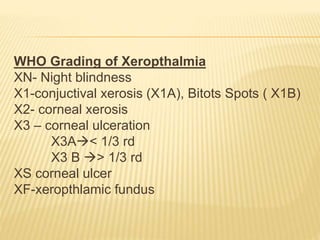 WHO Grading of Xeropthalmia
XN- Night blindness
X1-conjuctival xerosis (X1A), Bitots Spots ( X1B)
X2- corneal xerosis
X3 – corneal ulceration
X3A< 1/3 rd
X3 B > 1/3 rd
XS corneal ulcer
XF-xeropthlamic fundus
 