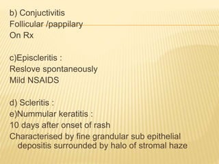b) Conjuctivitis
Follicular /pappilary
On Rx
c)Episcleritis :
Reslove spontaneously
Mild NSAIDS
d) Scleritis :
e)Nummular keratitis :
10 days after onset of rash
Characterised by fine grandular sub epithelial
depositis surrounded by halo of stromal haze
 