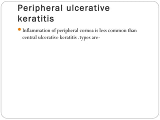 Peripheral ulcerative
keratitis
Inflammation of peripheral cornea is less common than
central ulcerative keratitis .types are-
 