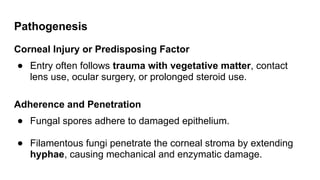 Pathogenesis
Corneal Injury or Predisposing Factor
● Entry often follows trauma with vegetative matter, contact
lens use, ocular surgery, or prolonged steroid use.
Adherence and Penetration
● Fungal spores adhere to damaged epithelium.
● Filamentous fungi penetrate the corneal stroma by extending
hyphae, causing mechanical and enzymatic damage.
 