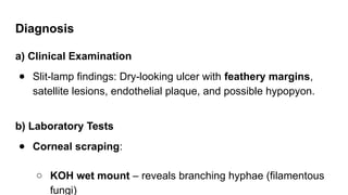 Diagnosis
a) Clinical Examination
● Slit-lamp findings: Dry-looking ulcer with feathery margins,
satellite lesions, endothelial plaque, and possible hypopyon.
b) Laboratory Tests
● Corneal scraping:
○ KOH wet mount – reveals branching hyphae (filamentous
fungi)
 