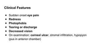 Clinical Features
● Sudden onset eye pain
● Redness
● Photophobia
● Tearing or discharge
● Decreased vision
● On examination: corneal ulcer, stromal infiltration, hypopyon
(pus in anterior chamber)
 
