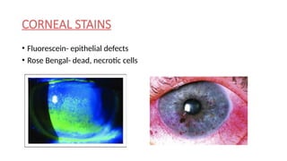 Comprehensive Overview of Corneal Anatomy and Physiology in ...