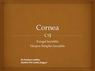 Fungal keratitis
Herpes Simplex keratitis
Dr.Pradnya Laddha,
SAANVI EYE CLINIC,Nagpur
 