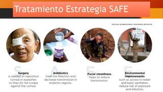 Tratamiento Estrategia SAFE
 