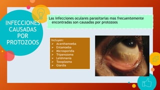 INFECCIONES
CAUSADAS
POR
PROTOZOOS
Las infecciones oculares parasitarias mas frecuentemente
encontradas son causadas por protozoos
Incluyen:
 Acanthamoeba
 Entamoeba
 Microsporidia
 Tripanozoma
 Leishmania
 Toxoplasma
 Giardia
 
