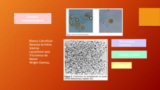Estudios
histopatológicos
Blanco Calcoflúor
Naranja Acridina
Giemsa
Lactofenol azul
Tricromica de
Mazon
Wright-Giemsa.
PCR
Biopsia Corneal
Microscópía
Confocal
 