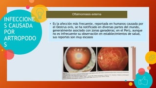 INFECCIONE
S CAUSADA
POR
ARTROPODO
S
• Es la afección más frecuente, reportada en humanos causada por
el Oestrus ovis, se ha notificado en diversas partes del mundo,
generalmente asociado con zonas ganaderas; en el Perú, aunque
no es infrecuente su observación en establecimientos de salud,
sus reportes son muy escasos
Oftalmomiasis externa
 