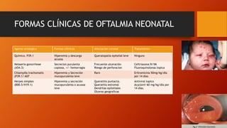 FORMAS CLÍNICAS DE OFTALMIA NEONATAL
Agente etiologico Formas cllinicas Afectación corneal Tratamiento
Químico. P39.1 Hiperemia y descarga
acuosa
Queratopatia epitelial leve Ninguno
Neisseria gonorrheae
(A54.3)
Secrecion purulenta
copiosa, +/- hemorragia
Frecuente ulceración
Riesgo de perforacion
Ceftriaxona IV/IM
Fluoroquinolonas topica
Chlamydia trachomatis
(P39.1/ A07
Hiperemia y Secreción
mucopurulenta leve
Raro Eritromicina 50mg/kg/día
por 14 dias
Herpes simplex
(B00.5/H19.1)
Hiperemia y secreción
mucopurulenta o acuosa
leve
Queratitis puntacta.
Queratitis estromal
Dendritas epiteliales
Úlceras geograficas
Antiviral topico
Acyclovir 60 mg/kg/día por
14 días.
 