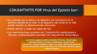 CONJUNTIVITIS POR Virus del Epstein barr
Se extiende por la saliva y se adquiere con frecuencia en la
primera década de la vida. Si se adquiere más tarde en la vida
puede resultar en Mononucleosis infecciosa.
Puede afectar a todas las capas del ojo
Las manifestaciones oculares son: Conjuntivitis membranosa o
folicular, ocasionalmente asociada con conjuntivitis hemorrágica
Las formas agudas pueden presentar folículos, hemorragias,
infiltrados blancos focales o membranas conjuntivales.
Las formas crónicas tienden a tener una mayor afectación posterior
del ojo incluyendo uveítis-panuveitis con hinchazón del disco óptico
y edema macular.
 