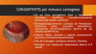 CONJUNTIVITIS por molusco contagioso
Es un virus oncogénico (piel y membranas
mucosas). Prolifera intradérmicamente
provocando lesión umbilical
Histopatologicamente: Cuerpos de Henderson-
Patterson como, inclusión eosinofílica,
inclusiones intracitoplásmica dentro de las
células epidérmicas.
Afecta: Niños, jóvenes y adultos sexualmente
activos e inmunocomprometidos.
Vía de Contagio: Contacto directo, Fómites
Benigno con resolución espontanea dentro 6-9
meses
 