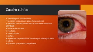 Cuadro clínico
 Adenomegalias preauriculares.
 Secreción serosa ocular (post. Mucopurulenta).
 Precedida de cuadro infeccioso de vías aéreas superiores.
SÍNTOMAS
 Dolor ocular intenso
 Fotofobia
 Visión borrosa
 Epífora
 Hiperemia conjuntival con hemorragias subconjuntivales
 Edema
 Quemosis (conjuntiva) palpebrales.
 