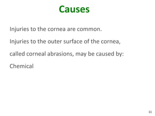 11
Causes
Injuries to the cornea are common.
Injuries to the outer surface of the cornea,
called corneal abrasions, may be caused by:
Chemical
 