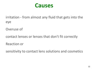 12
Causes
irritation - from almost any fluid that gets into the
eye
Overuse of
contact lenses or lenses that don't fit correctly
Reaction or
sensitivity to contact lens solutions and cosmetics
 