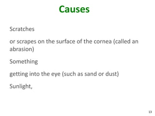 13
Causes
Scratches
or scrapes on the surface of the cornea (called an
abrasion)
Something
getting into the eye (such as sand or dust)
Sunlight,
 
