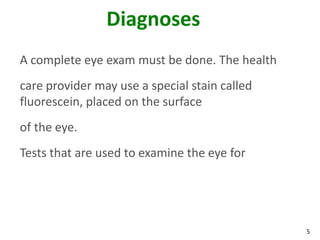 5
Diagnoses
A complete eye exam must be done. The health
care provider may use a special stain called
fluorescein, placed on the surface
of the eye.
Tests that are used to examine the eye for
 