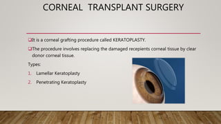 CORNEAL TRANSPLANT SURGERY
It is a corneal grafting procedure called KERATOPLASTY.
The procedure involves replacing the damaged recepients corneal tissue by clear
donor corneal tissue.
Types:
1. Lamellar Keratoplasty
2. Penetrating Keratoplasty
 