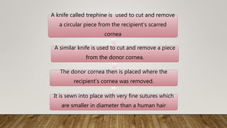 A knife called trephine is used to cut and remove
a circular piece from the recipient’s scarred
cornea
A similar knife is used to cut and remove a piece
from the donor cornea.
The donor cornea then is placed where the
recipient’s cornea was removed.
It is sewn into place with very fine sutures which
are smaller in diameter than a human hair
 