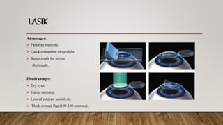 LASIK
Advantages:
 Pain free recovery.
 Quick restoration of eyesight.
 Better result for severe
short sight.
Disadvantages:
 Dry eyes.
 Halos, starburst.
 Loss of contrast sensitivity.
 Thick corneal flap (100-180 microns).
 