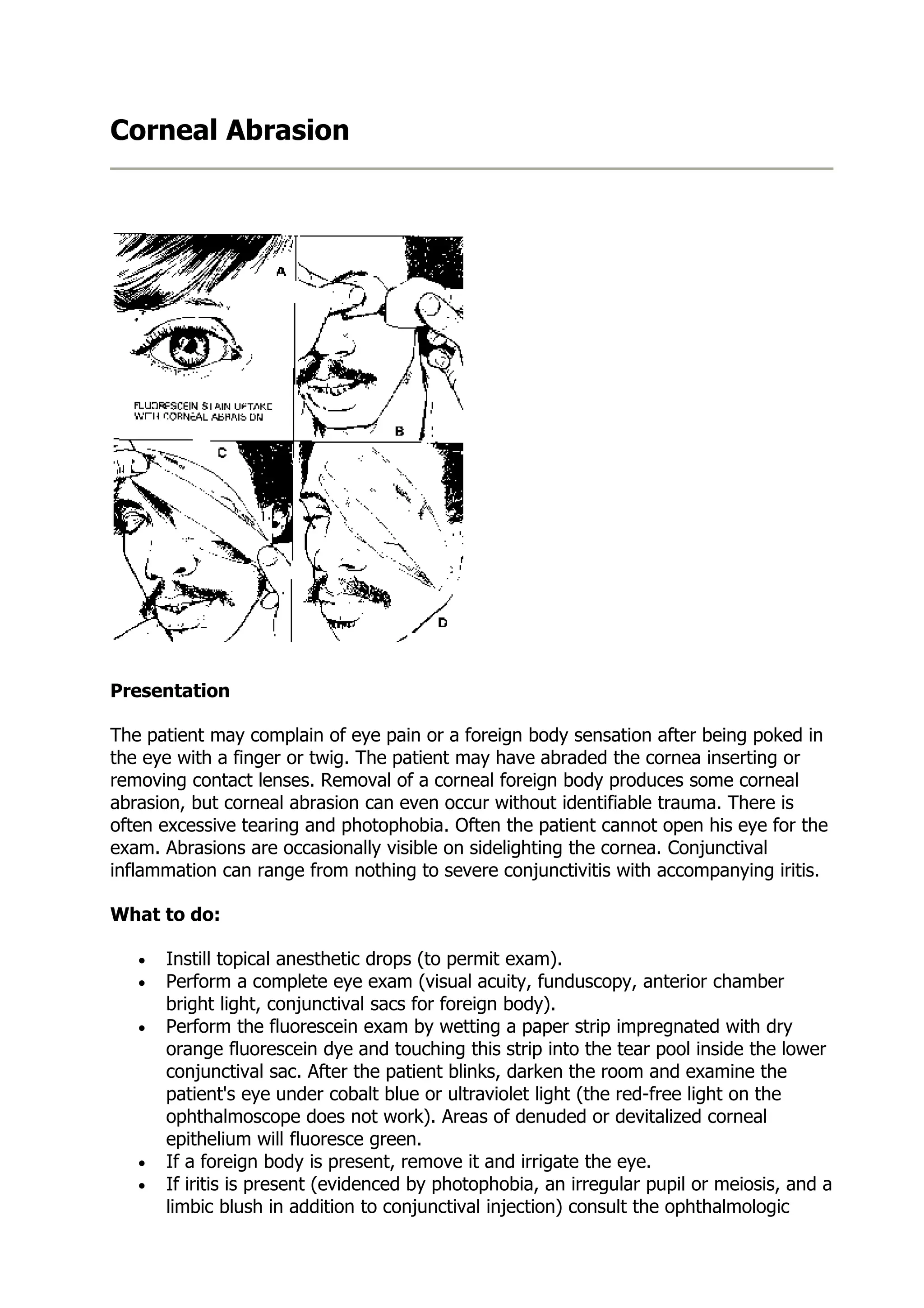 Corneal Abrasion | DOC