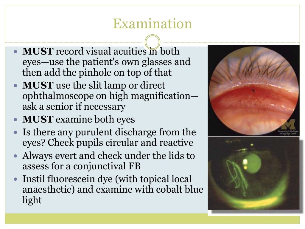 Corneal abrasions and f bs