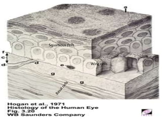 Squamous cells
Wing cells
 