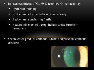 • Deleterious effects of CL  Due to low O2 permeability 
• Epithelial thinning 
• Reduction in the hemidesmosome density 
• Reduction in anchoring fibrils 
• Reduce adhesion of the epithelium to the basement 
membrane 
• Severe cases produce epithelial edema and punctate epithelial 
erosions 
 