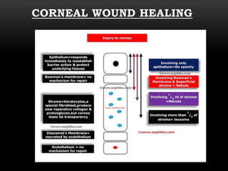 CORNEAL WOUND HEALING 
 