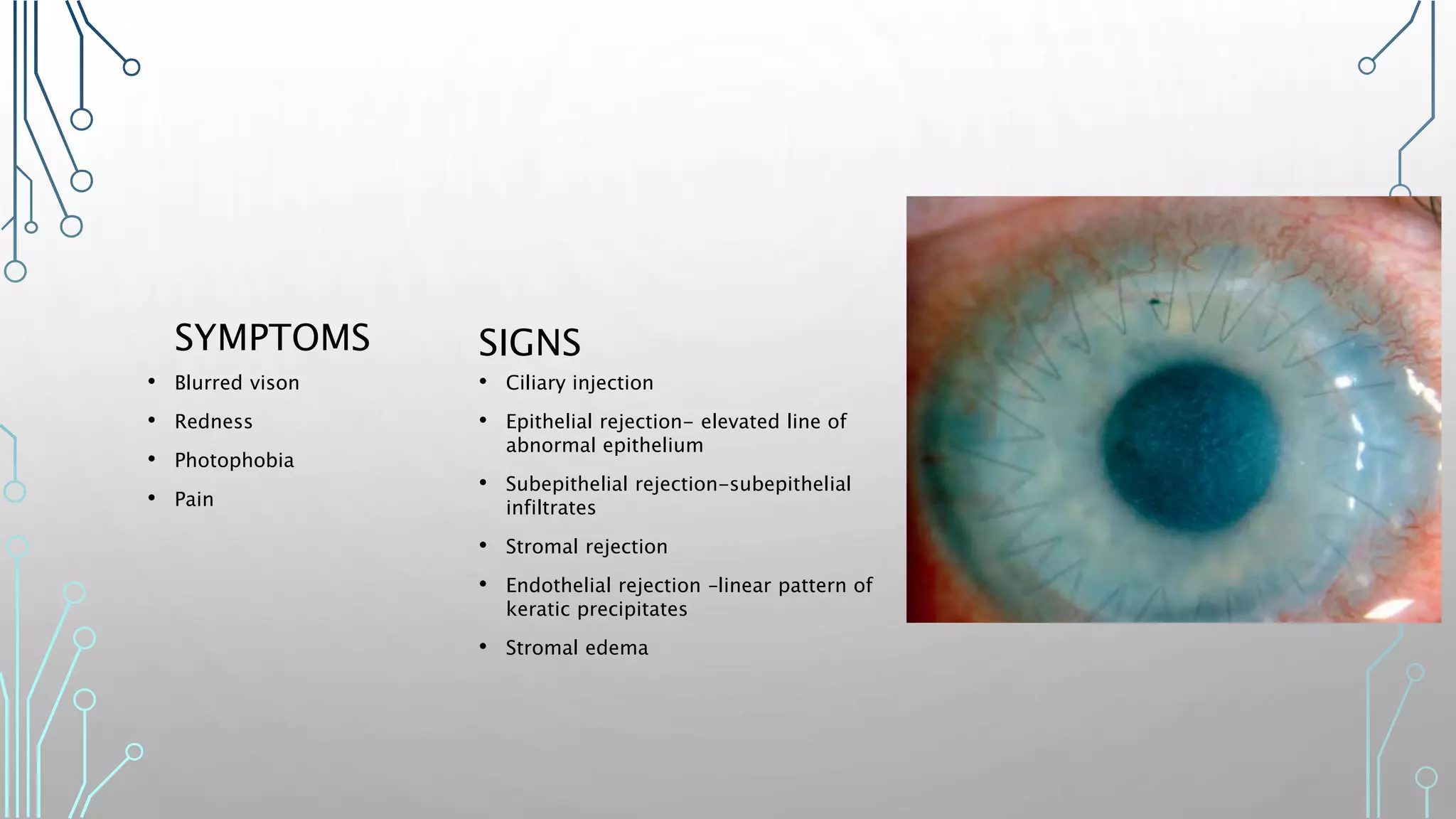 CORNEAL AND REFRACTIVE SURGERY | PPTX